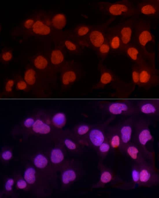 Immunocytochemistry/ Immunofluorescence: Methyltransferase like 3 Antibody - Azide and BSA Free [Methyltransferase like 3] - Immunofluorescence analysis of HepG2 cells using Methyltransferase like 3 Rabbit pAb  at dilution of 1:100 (40x lens). Secondary antibody: Cy3-conjugated Goat anti-Rabbit IgG (H+L)  at 1:500 dilution. Blue: DAPI for nuclear staining.