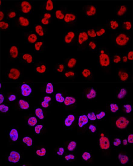 Immunocytochemistry/ Immunofluorescence: Methyltransferase like 3 Antibody - Azide and BSA Free [Methyltransferase like 3] - Confocal immunofluorescence analysis of Hela cells using Methyltransferase like 3 Rabbit pAb  at dilution of 1:200. Blue: DAPI for nuclear staining.