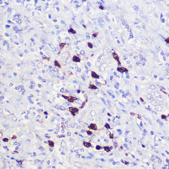 Immunohistochemistry: p21/CIP1/CDKN1A Antibody - BSA Free [p21/CIP1/CDKN1A] - Immunohistochemistry analysis of paraffin-embedded Human liver using p21/CIP1/CDKN1A Rabbit pAb  at dilution of 1:100 (40x lens). High pressure antigen retrieval performed with 0.01M Citrate Bufferr (pH 6.0) prior to IHC staining.