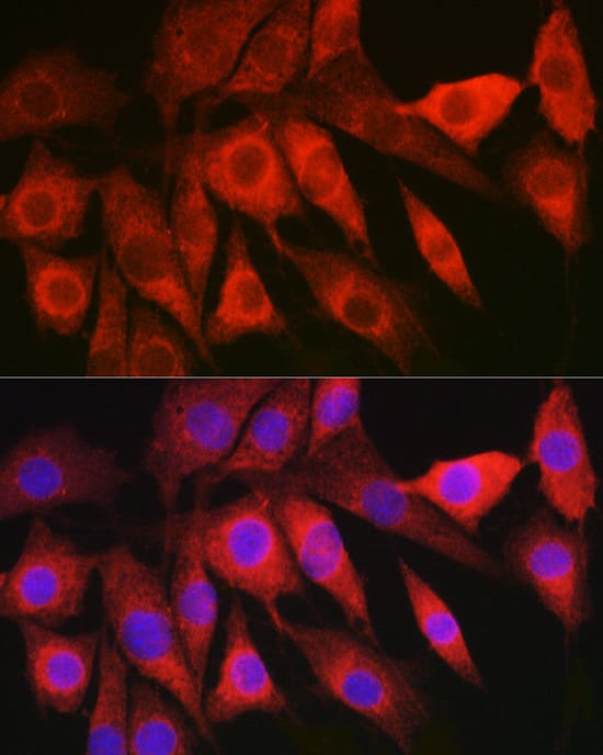 Immunocytochemistry/ Immunofluorescence: HBXIP Antibody - BSA Free [HBXIP] - Immunofluorescence analysis of NIH/3T3 cells using HBXIP Rabbit pAb  at dilution of 1:200 (40x lens). Secondary antibody: Cy3-conjugated Goat anti-Rabbit IgG (H+L)  at 1:500 dilution. Blue: DAPI for nuclear staining.