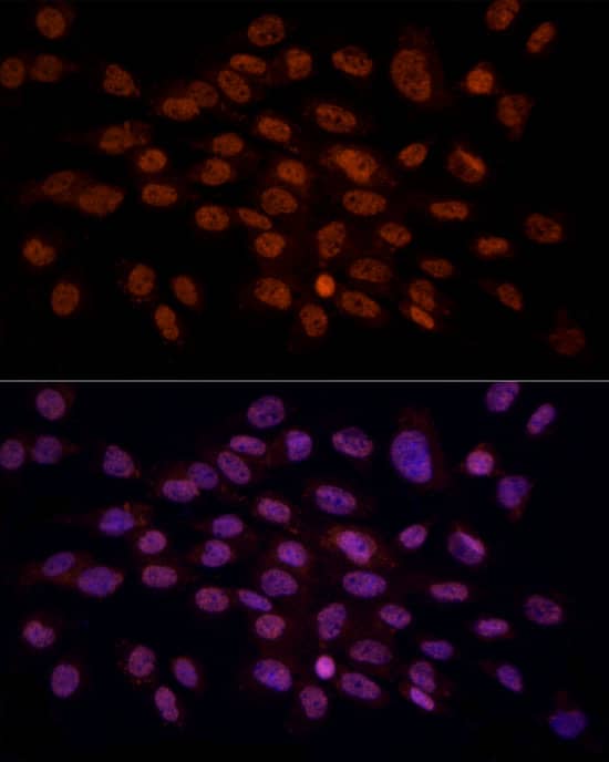 Immunocytochemistry/ Immunofluorescence gamma C Crystallin Antibody - BSA Free