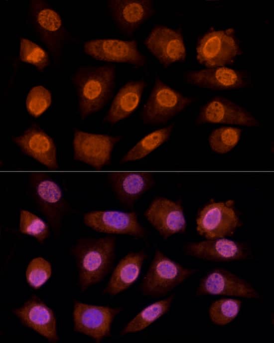 Immunocytochemistry/ Immunofluorescence gamma C Crystallin Antibody - BSA Free