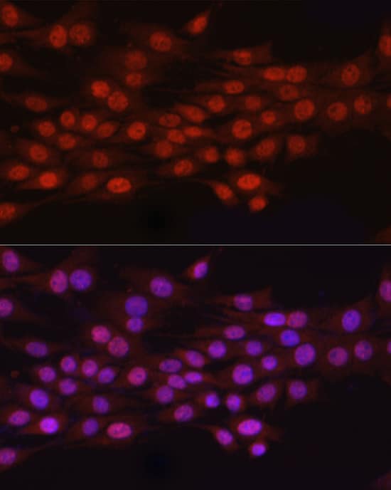 Immunocytochemistry/ Immunofluorescence HEMK2 Antibody - Azide and BSA Free