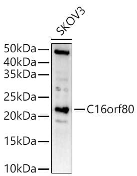 Western Blot: EVORF Antibody - Azide and BSA Free [EVORF] - Western blot analysis of lysates from SKOV3 cells, using EVORF Rabbit pAb  at  1:1000 dilution.Secondary antibody: HRP-conjugated Goat anti-Rabbit IgG (H+L)  at 1:10000 dilution.Lysates/proteins: 25ug per lane.Blocking buffer: 3% nonfat dry milk in TBST.Detection: ECL Basic Kit .Exposure time: 180s.