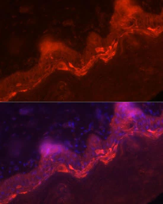 Immunocytochemistry/ Immunofluorescence: IL-36 gamma/IL-1F9 Antibody - Azide and BSA Free [IL-36 gamma/IL-1F9] - Immunofluorescence analysis of paraffin-embedded human skin using IL-36 gamma/IL-1F9 Rabbit pAb  at dilution of 1:100 (40x lens). Secondary antibody: Cy3-conjugated Goat anti-Rabbit IgG (H+L)  at 1:500 dilution. Blue: DAPI for nuclear staining.