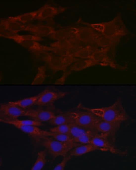 Immunocytochemistry/ Immunofluorescence: Glucuronosyltransferase 1A1/UGT1A1 Antibody - Azide and BSA Free [Glucuronosyltransferase 1A1/UGT1A1] - Immunofluorescence analysis of C6 cells using Glucuronosyltransferase 1A1/UGT1A1 Rabbit pAb  at dilution of 1:200 (40x lens). Secondary antibody: Cy3-conjugated Goat anti-Rabbit IgG (H+L)  at 1:500 dilution. Blue: DAPI for nuclear staining.