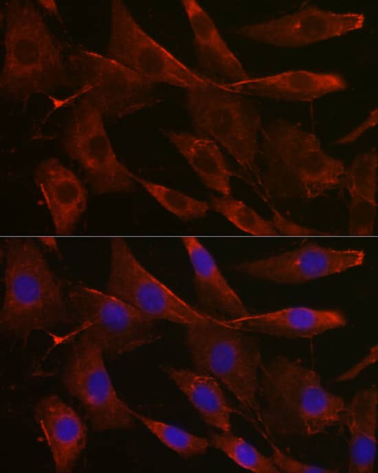 Immunocytochemistry/ Immunofluorescence: Glucuronosyltransferase 1A1/UGT1A1 Antibody - Azide and BSA Free [Glucuronosyltransferase 1A1/UGT1A1] - Immunofluorescence analysis of NIH/3T3 cells using Glucuronosyltransferase 1A1/UGT1A1 Rabbit pAb  at dilution of 1:200 (40x lens). Secondary antibody: Cy3-conjugated Goat anti-Rabbit IgG (H+L)  at 1:500 dilution. Blue: DAPI for nuclear staining.