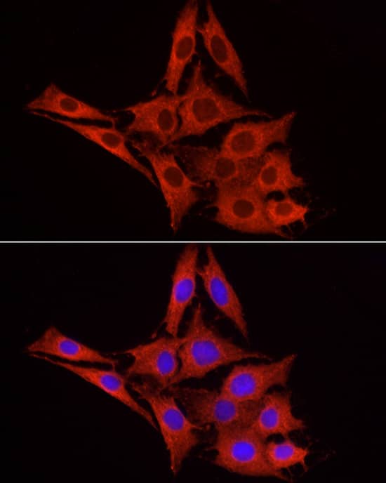 Immunocytochemistry/ Immunofluorescence: Glucuronosyltransferase 1A1/UGT1A1 Antibody - Azide and BSA Free [Glucuronosyltransferase 1A1/UGT1A1] - Immunofluorescence analysis of C6 cells using Glucuronosyltransferase 1A1/UGT1A1 Rabbit pAb  at dilution of 1:100 (40x lens). Secondary antibody: Cy3-conjugated Goat anti-Rabbit IgG (H+L)  at 1:500 dilution. Blue: DAPI for nuclear staining.