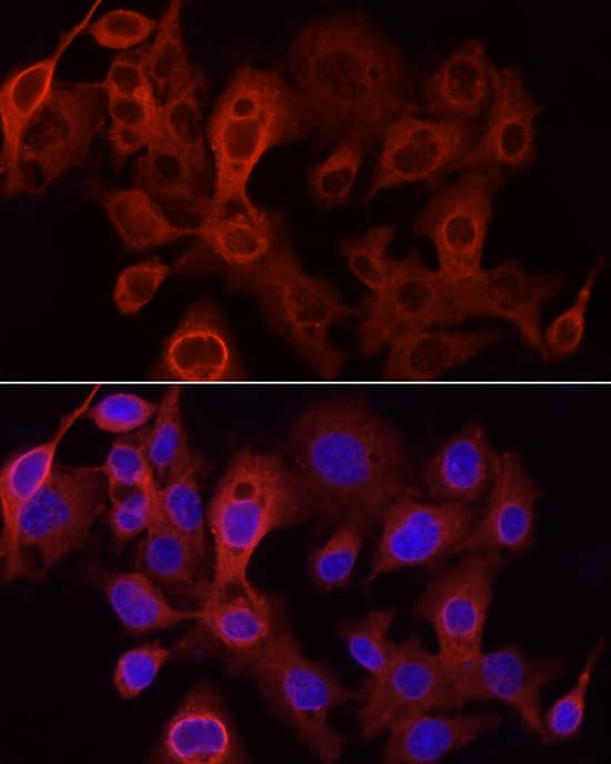 Immunocytochemistry/ Immunofluorescence: Glucuronosyltransferase 1A1/UGT1A1 Antibody - Azide and BSA Free [Glucuronosyltransferase 1A1/UGT1A1] - Immunofluorescence analysis of HepG2 cells using Glucuronosyltransferase 1A1/UGT1A1 Rabbit pAb  at dilution of 1:100 (40x lens). Secondary antibody: Cy3-conjugated Goat anti-Rabbit IgG (H+L)  at 1:500 dilution. Blue: DAPI for nuclear staining.