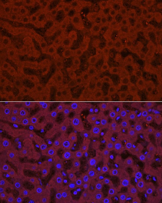 Immunocytochemistry/ Immunofluorescence: Glucuronosyltransferase 1A1/UGT1A1 Antibody - Azide and BSA Free [Glucuronosyltransferase 1A1/UGT1A1] - Immunofluorescence analysis of paraffin-embedded rat liver using Glucuronosyltransferase 1A1/UGT1A1 Rabbit pAb  at dilution of 1:100 (40x lens). Secondary antibody: Cy3-conjugated Goat anti-Rabbit IgG (H+L)  at 1:500 dilution. Blue: DAPI for nuclear staining.