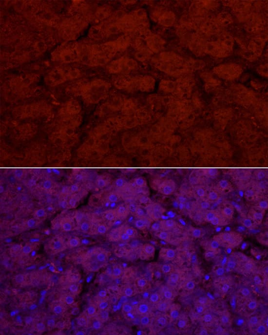 Immunocytochemistry/ Immunofluorescence: Glucuronosyltransferase 1A1/UGT1A1 Antibody - Azide and BSA Free [Glucuronosyltransferase 1A1/UGT1A1] - Immunofluorescence analysis of paraffin-embedded human liver using Glucuronosyltransferase 1A1/UGT1A1 Rabbit pAb  at dilution of 1:100 (40x lens). Secondary antibody: Cy3-conjugated Goat anti-Rabbit IgG (H+L)  at 1:500 dilution. Blue: DAPI for nuclear staining.