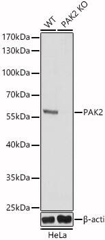 <b>Genetic Strategies Validation. </b>Western Blot: PAK2 Antibody - Azide and BSA Free [PAK2] - Western blot analysis of lysates from wild type(WT) and PAK2 knockout (KO) HeLa(KO) cells, using [KO Validated] PAK2 Rabbit pAb  at 1:1000 dilution.Secondary antibody: HRP-conjugated Goat anti-Rabbit IgG (H+L)  at 1:10000 dilution.Lysates/proteins: 25ug per lane.Blocking buffer: 3% nonfat dry milk in TBST.Detection: ECL Basic Kit .Exposure time: 1s.