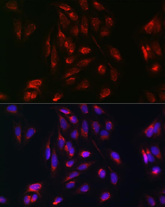 Immunocytochemistry/ Immunofluorescence: Rab5a Antibody - Azide and BSA Free [Rab5a] - Immunofluorescence analysis of U-2 OS cells using Rab5a Rabbit pAb  at dilution of 1:100 (40x lens). Secondary antibody: Cy3-conjugated Goat anti-Rabbit IgG (H+L)  at 1:500 dilution. Blue: DAPI for nuclear staining.