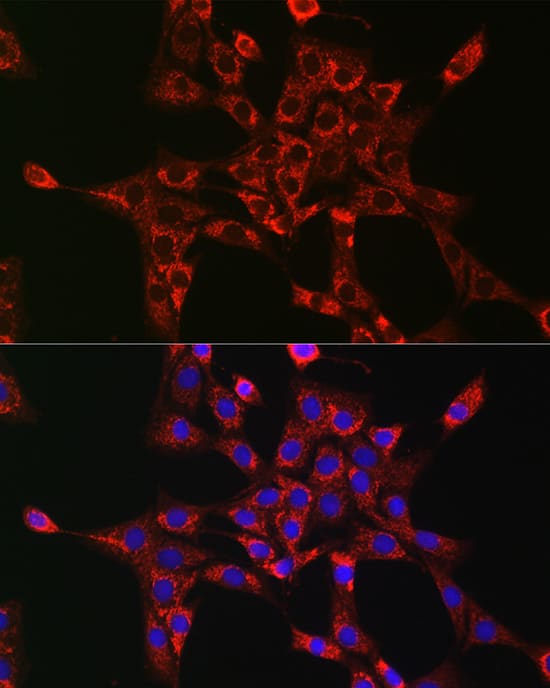 Immunocytochemistry/ Immunofluorescence: Rab5a Antibody - Azide and BSA Free [Rab5a] - Immunofluorescence analysis of NIH-3T3 cells using Rab5a Rabbit pAb  at dilution of 1:100 (40x lens). Secondary antibody: Cy3-conjugated Goat anti-Rabbit IgG (H+L)  at 1:500 dilution. Blue: DAPI for nuclear staining.