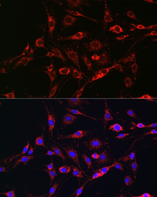 Immunocytochemistry/ Immunofluorescence: Rab5a Antibody - Azide and BSA Free [Rab5a] - Immunofluorescence analysis of C6 cells using Rab5a Rabbit pAb  at dilution of 1:100 (40x lens). Secondary antibody: Cy3-conjugated Goat anti-Rabbit IgG (H+L)  at 1:500 dilution. Blue: DAPI for nuclear staining.