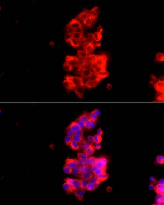 <b>Genetic Strategies Validation. </b>Immunocytochemistry/ Immunofluorescence: Rab27a Antibody - BSA Free [NBP3-03369] - Immunofluorescence analysis of HepG2 cells using [KD Validated] Rab27a Rabbit pAb  at dilution of 1:100 (40x lens). Secondary antibody: Cy3 Goat Anti-Rabbit IgG (H+L)  at 1:500 dilution. Blue: DAPI for nuclear staining.