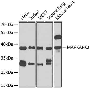 <b>Genetic Strategies Validation. </b>Western Blot: MAPKAP Kinase 3 Antibody - Azide and BSA Free [MAPKAP Kinase 3] - Western blot analysis of various lysates using MAPKAP Kinase 3 Rabbit pAb  at 1:1000 dilution.Secondary antibody: HRP-conjugated Goat anti-Rabbit IgG (H+L)  at 1:10000 dilution.Lysates/proteins: 25ug per lane.Blocking buffer: 3% nonfat dry milk in TBST.Detection: ECL Enhanced Kit .Exposure time: 90s.