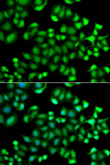 Immunocytochemistry/ Immunofluorescence: MAPKAP Kinase 3 Antibody - Azide and BSA Free [MAPKAP Kinase 3] - Immunofluorescence analysis of A549 cells using MAPKAP Kinase 3 Rabbit pAb . Secondary antibody: Cy3-conjugated Goat anti-Rabbit IgG (H+L)  at 1:500 dilution. Blue: DAPI for nuclear staining.