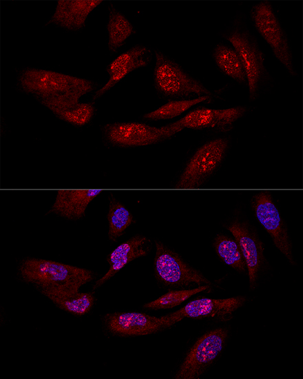 Immunocytochemistry/ Immunofluorescence: integrin beta 4 binding protein Antibody - BSA Free [integrin beta 4 binding protein] - Confocal immunofluorescence analysis of U-2OS cells using integrin beta 4 binding protein antibody  at dilution of 1:50. Blue: DAPI for nuclear staining.