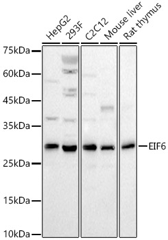 Western Blot: integrin beta 4 binding protein Antibody - BSA Free [integrin beta 4 binding protein] - Western blot analysis of various lysates, using integrin beta 4 binding protein Rabbit pAb  at 1:2000 dilution.Secondary antibody: HRP Goat Anti-Rabbit IgG (H+L)  at 1:10000 dilution.Lysates/proteins: 25ug per lane.Blocking buffer: 3% nonfat dry milk in TBST.Detection: ECL Basic Kit .Exposure time: 30s.