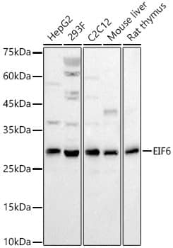 Western Blot: integrin beta 4 binding protein Antibody - BSA Free [NBP3-03384] - Western blot analysis of various lysates, using integrin beta 4 binding protein Rabbit pAb (A1818) at 1:2000 dilution.Secondary antibody: HRP Goat Anti-Rabbit IgG (H+L) (AS014) at 1:10000 dilution.Lysates/proteins: 25μg per lane.Blocking buffer: 3% nonfat dry milk in TBST.Detection: ECL Basic Kit (RM00020).Exposure time: 30s.