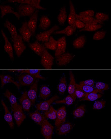 Immunocytochemistry/ Immunofluorescence: integrin beta 4 binding protein Antibody - BSA Free [NBP3-03384] - Confocal immunofluorescence analysis of Hela cells using integrin beta 4 binding protein antibody (A1818) at dilution of 1:50. Blue: DAPI for nuclear staining.