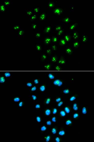 Immunocytochemistry/ Immunofluorescence: integrin beta 4 binding protein Antibody - BSA Free [NBP3-03384] - Immunofluorescence analysis of MCF-7 cells using integrin beta 4 binding protein antibody (A1818). Blue: DAPI for nuclear staining.