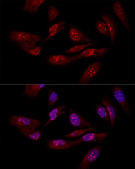 Immunocytochemistry/ Immunofluorescence: integrin beta 4 binding protein Antibody - BSA Free [NBP3-03384] - Confocal immunofluorescence analysis of U-2OS cells using integrin beta 4 binding protein antibody (A1818) at dilution of 1:50. Blue: DAPI for nuclear staining.