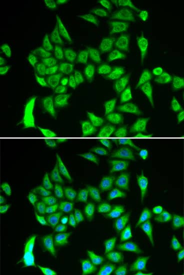 Immunocytochemistry/ Immunofluorescence: IRP2 Antibody - Azide and BSA Free [IRP2] - Immunofluorescence analysis of A549 cells using IRP2 Rabbit pAb . Secondary antibody: Cy3-conjugated Goat anti-Rabbit IgG (H+L)  at 1:500 dilution. Blue: DAPI for nuclear staining.