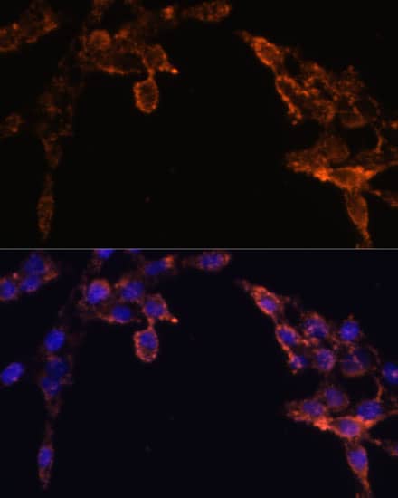 Immunocytochemistry/ Immunofluorescence: POR/Cytochrome P450 Reductase Antibody - BSA Free [POR/Cytochrome P450 Reductase] - Immunofluorescence analysis of HeLa cells using [KO Validated] POR/Cytochrome P450 Reductase Rabbit pAb  at dilution of 1:100 (40x lens). Secondary antibody: Cy3 Goat Anti-Rabbit IgG (H+L)  at 1:500 dilution. Blue: DAPI for nuclear staining.