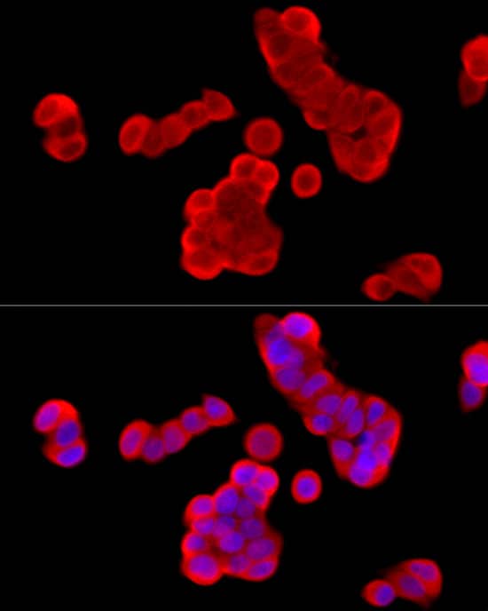 Immunocytochemistry/ Immunofluorescence Cytochrome b245 alpha Antibody - BSA Free