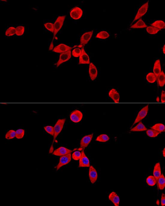 Immunocytochemistry/ Immunofluorescence: Cytochrome b245 alpha Antibody - BSA Free [NBP3-03403] - Immunofluorescence analysis of NIH/3T3 cells using Cytochrome b245 alpha Rabbit pAb (A10694) at dilution of 1:100 (40x lens). Blue: DAPI for nuclear staining.