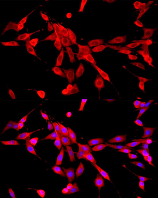 Immunocytochemistry/ Immunofluorescence Cytochrome b245 alpha Antibody - BSA Free