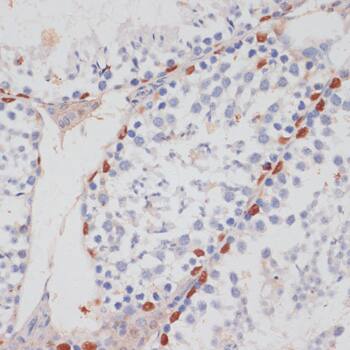 Immunohistochemistry: HIV-1 Tat specific factor 1 Antibody - BSA Free [HIV-1 Tat specific factor 1] - Immunohistochemistry analysis of paraffin-embedded Mouse testis using HIV-1 Tat specific factor 1 Rabbit pAb  at dilution of 1:100 (40x lens). Microwave antigen retrieval performed with 0.01M PBS Buffer (pH 7.2) prior to IHC staining.