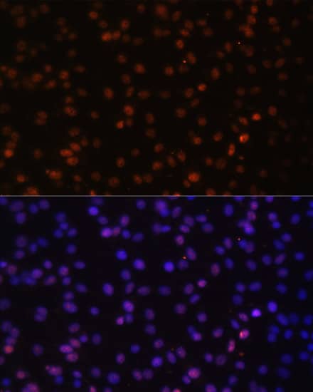 Immunocytochemistry/ Immunofluorescence: HIV-1 Tat specific factor 1 Antibody - BSA Free [HIV-1 Tat specific factor 1] - Immunofluorescence analysis of C6 cells using HIV-1 Tat specific factor 1 Rabbit pAb  at dilution of 1:100. Secondary antibody: Cy3-conjugated Goat anti-Rabbit IgG (H+L)  at 1:500 dilution. Blue: DAPI for nuclear staining.