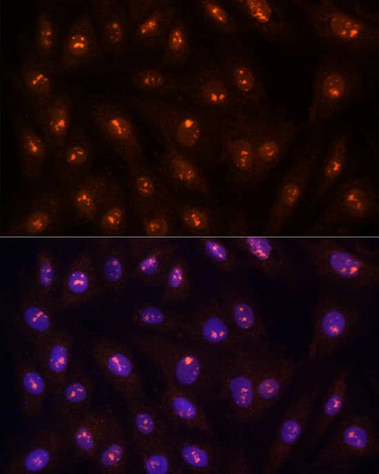 Immunocytochemistry/ Immunofluorescence: Protein Phosphatase 1C gamma Antibody - BSA Free [NBP3-03445] - Immunofluorescence analysis of H9C2 cells using [KO Validated] Protein Phosphatase 1C gamma Rabbit pAb (A4035) at dilution of 1:100 (40x lens). Blue: DAPI for nuclear staining.