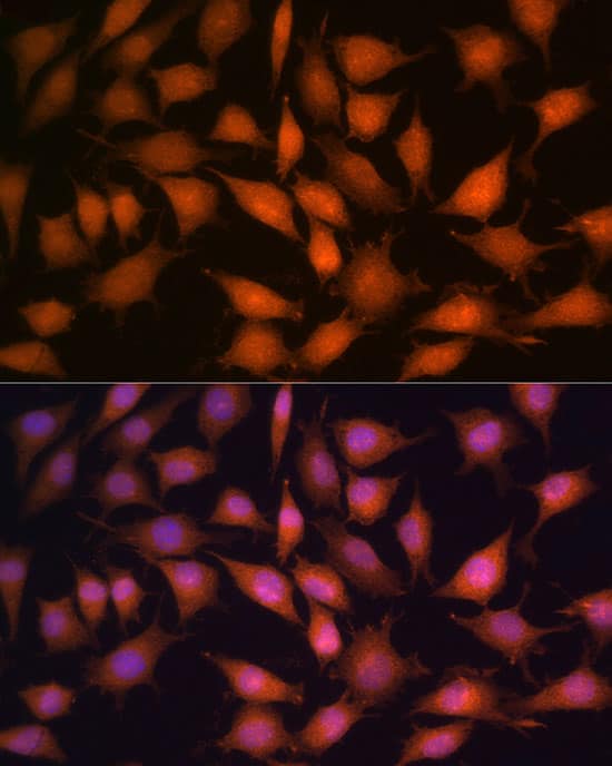 Immunocytochemistry/ Immunofluorescence: Protein Phosphatase 1C gamma Antibody - BSA Free [NBP3-03445] - Immunofluorescence analysis of L929 cells using [KO Validated] Protein Phosphatase 1C gamma Rabbit pAb (A4035) at dilution of 1:100 (40x lens). Blue: DAPI for nuclear staining.