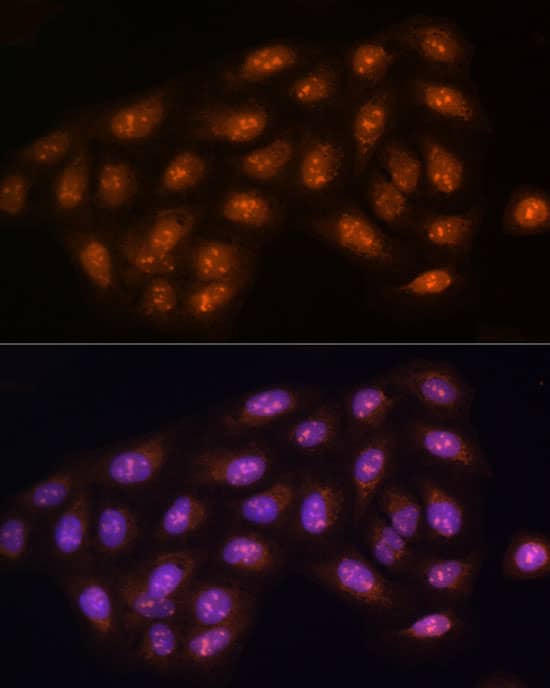 Immunocytochemistry/ Immunofluorescence: Protein Phosphatase 1C gamma Antibody - BSA Free [NBP3-03445] - Immunofluorescence analysis of U2OS cells using [KO Validated] Protein Phosphatase 1C gamma Rabbit pAb (A4035) at dilution of 1:100 (40x lens). Blue: DAPI for nuclear staining.