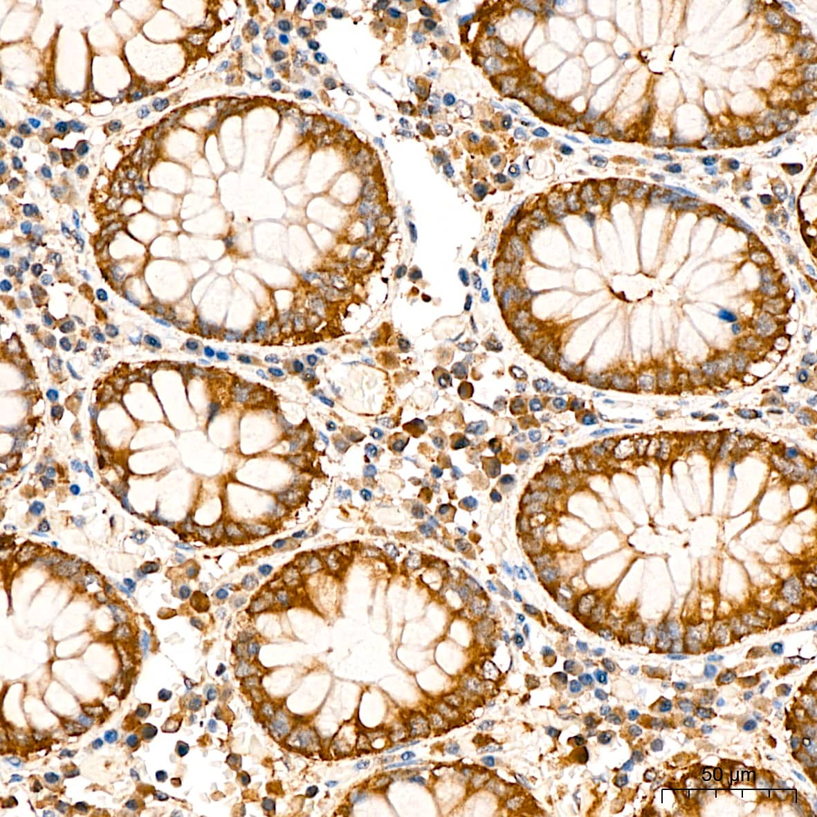Immunohistochemistry: Lactate Dehydrogenase B Antibody - BSA Free [Lactate Dehydrogenase B] - Immunohistochemistry analysis of Lactate Dehydrogenase B in paraffin-embedded Human colon tissue using Lactate Dehydrogenase B Rabbit pAb  at a dilution of 1:200 (40x lens). High pressure antigen retrieval performed with 0.01M Citrate Buffer(pH 6.0) prior to IHC staining.