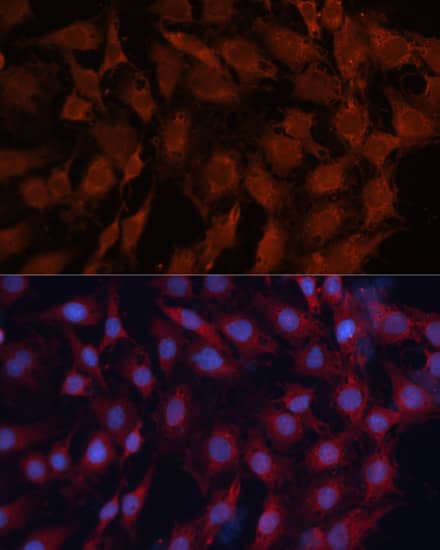 Immunocytochemistry/ Immunofluorescence: HSP40/DNAJB1 Antibody - BSA Free [HSP40/DNAJB1] - Immunofluorescence analysis of C6 cells using [KO Validated] HSP40/DNAJB1 Rabbit pAb  at dilution of 1:100. Secondary antibody: Cy3 Goat Anti-Rabbit IgG (H+L)  at 1:500 dilution. Blue: DAPI for nuclear staining.