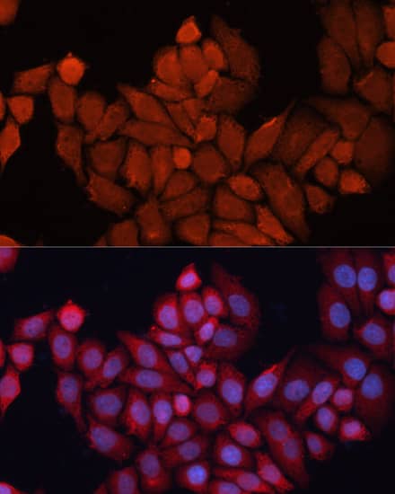 Immunocytochemistry/ Immunofluorescence: HSP40/DNAJB1 Antibody - BSA Free [HSP40/DNAJB1] - Immunofluorescence analysis of HeLa cells using [KO Validated] HSP40/DNAJB1 Rabbit pAb  at dilution of 1:100. Secondary antibody: Cy3 Goat Anti-Rabbit IgG (H+L)  at 1:500 dilution. Blue: DAPI for nuclear staining.