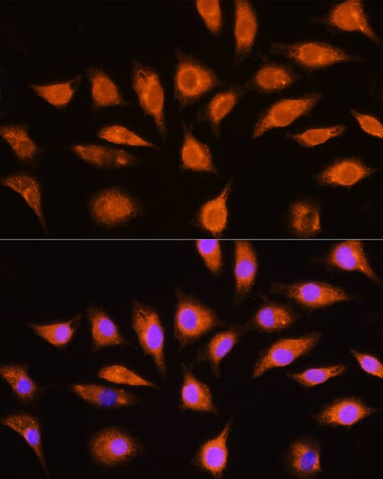 Immunocytochemistry/ Immunofluorescence: GNAI3 Antibody - BSA Free [NBP3-03467] - Immunofluorescence analysis of L929 cells using [KO Validated] GNAI3 Rabbit pAb (A13307) at dilution of 1:100 (40x lens). Secondary antibody: Cy3 Goat Anti-Rabbit IgG (H+L) (AS007) at 1:500 dilution. Blue: DAPI for nuclear staining.