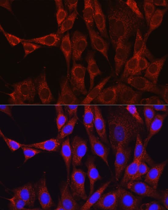 Immunocytochemistry/ Immunofluorescence: Glutamine Synthetase Antibody - BSA Free [Glutamine Synthetase] - Immunofluorescence analysis of NIH/3T3 cells using Glutamine Synthetase Rabbit pAb  at dilution of 1:100 (40x lens). Secondary antibody: Cy3 Goat Anti-Rabbit IgG (H+L)  at 1:500 dilution. Blue: DAPI for nuclear staining.