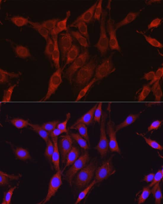 Immunocytochemistry/ Immunofluorescence: Glutamine Synthetase Antibody - BSA Free [Glutamine Synthetase] - Immunofluorescence analysis of PC-12 cells using Glutamine Synthetase Rabbit pAb  at dilution of 1:100 (40x lens). Secondary antibody: Cy3 Goat Anti-Rabbit IgG (H+L)  at 1:500 dilution. Blue: DAPI for nuclear staining.