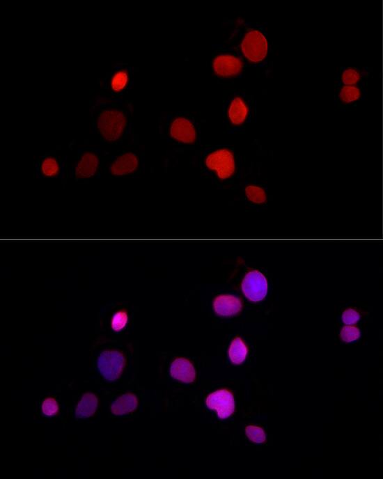 Immunocytochemistry/ Immunofluorescence: Thymopoietin/LAP2 Antibody - Azide and BSA Free [Thymopoietin/LAP2] - Immunofluorescence analysis of HepG2 cells using Thymopoietin/LAP2 Rabbit pAb  at dilution of 1:50 (40x lens). Secondary antibody: Cy3-conjugated Goat anti-Rabbit IgG (H+L)  at 1:500 dilution. Blue: DAPI for nuclear staining.