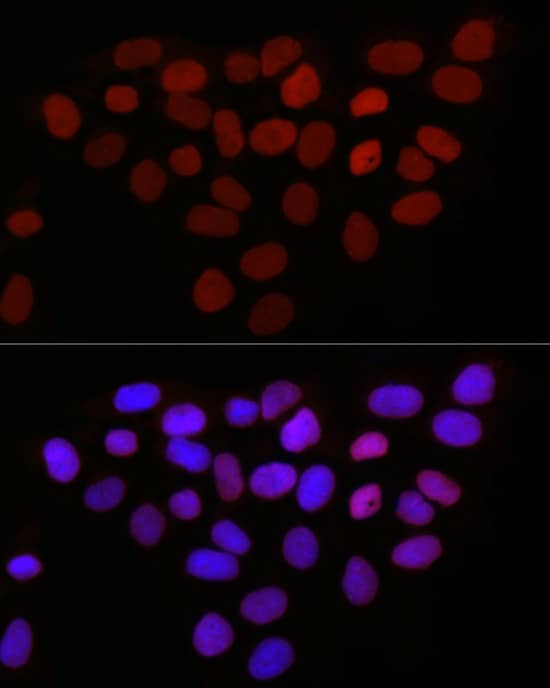 Immunocytochemistry/ Immunofluorescence: Thymopoietin/LAP2 Antibody - Azide and BSA Free [Thymopoietin/LAP2] - Immunofluorescence analysis of HeLa cells using Thymopoietin/LAP2 Rabbit pAb  at dilution of 1:50 (40x lens). Secondary antibody: Cy3-conjugated Goat anti-Rabbit IgG (H+L)  at 1:500 dilution. Blue: DAPI for nuclear staining.