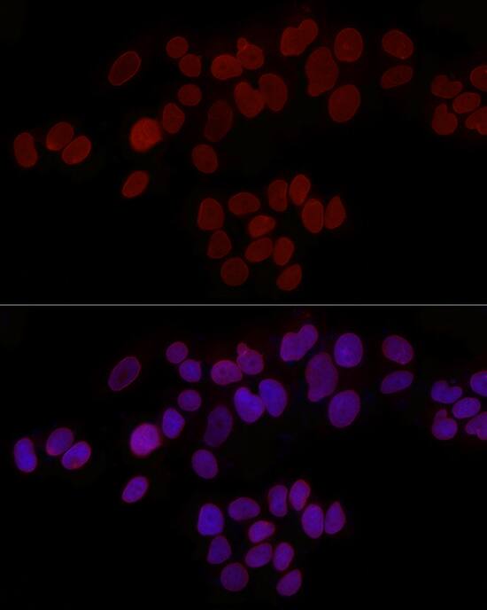 Immunocytochemistry/ Immunofluorescence: Thymopoietin/LAP2 Antibody - Azide and BSA Free [Thymopoietin/LAP2] - Immunofluorescence analysis of MCF7 cells using Thymopoietin/LAP2 Rabbit pAb  at dilution of 1:50 (40x lens). Secondary antibody: Cy3-conjugated Goat anti-Rabbit IgG (H+L)  at 1:500 dilution. Blue: DAPI for nuclear staining.