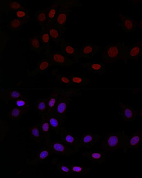 Immunocytochemistry/ Immunofluorescence: Thymopoietin/LAP2 Antibody - Azide and BSA Free [Thymopoietin/LAP2] - Immunofluorescence analysis of NIH/3T3 cells using Thymopoietin/LAP2 Rabbit pAb  at dilution of 1:50 (40x lens). Secondary antibody: Cy3-conjugated Goat anti-Rabbit IgG (H+L)  at 1:500 dilution. Blue: DAPI for nuclear staining.