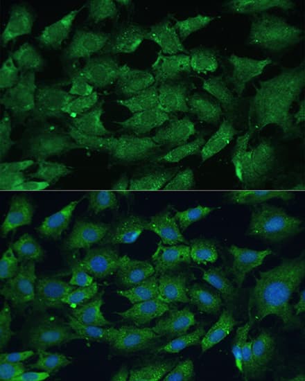 Immunocytochemistry/ Immunofluorescence: SHP-2/PTPN11 Antibody - Azide and BSA Free [SHP-2/PTPN11] - Immunofluorescence analysis of C6 cells using [KO Validated] SHP-2/PTPN11 Rabbit pAb  at dilution of 1:100. Blue: DAPI for nuclear staining.