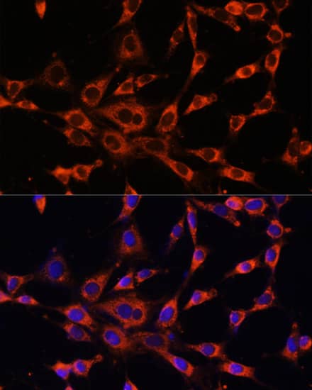 Immunocytochemistry/ Immunofluorescence: IP3R3 Antibody - Azide and BSA Free [IP3R3] - Immunofluorescence analysis of NIH-3T3 cells using IP3R3 Rabbit pAb  at dilution of 1:100. Secondary antibody: Cy3-conjugated Goat anti-Rabbit IgG (H+L)  at 1:500 dilution. Blue: DAPI for nuclear staining.